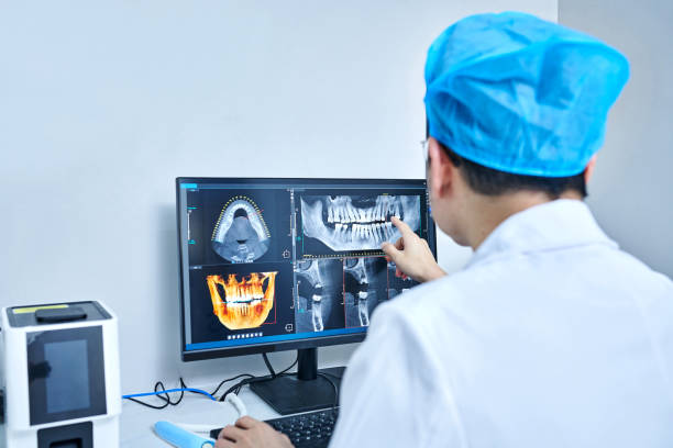 Best Emergency Wisdom Tooth Extraction in Ovid, MI